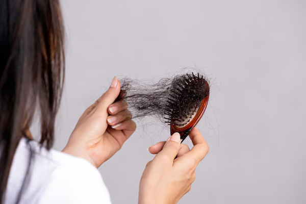 Hair Loss